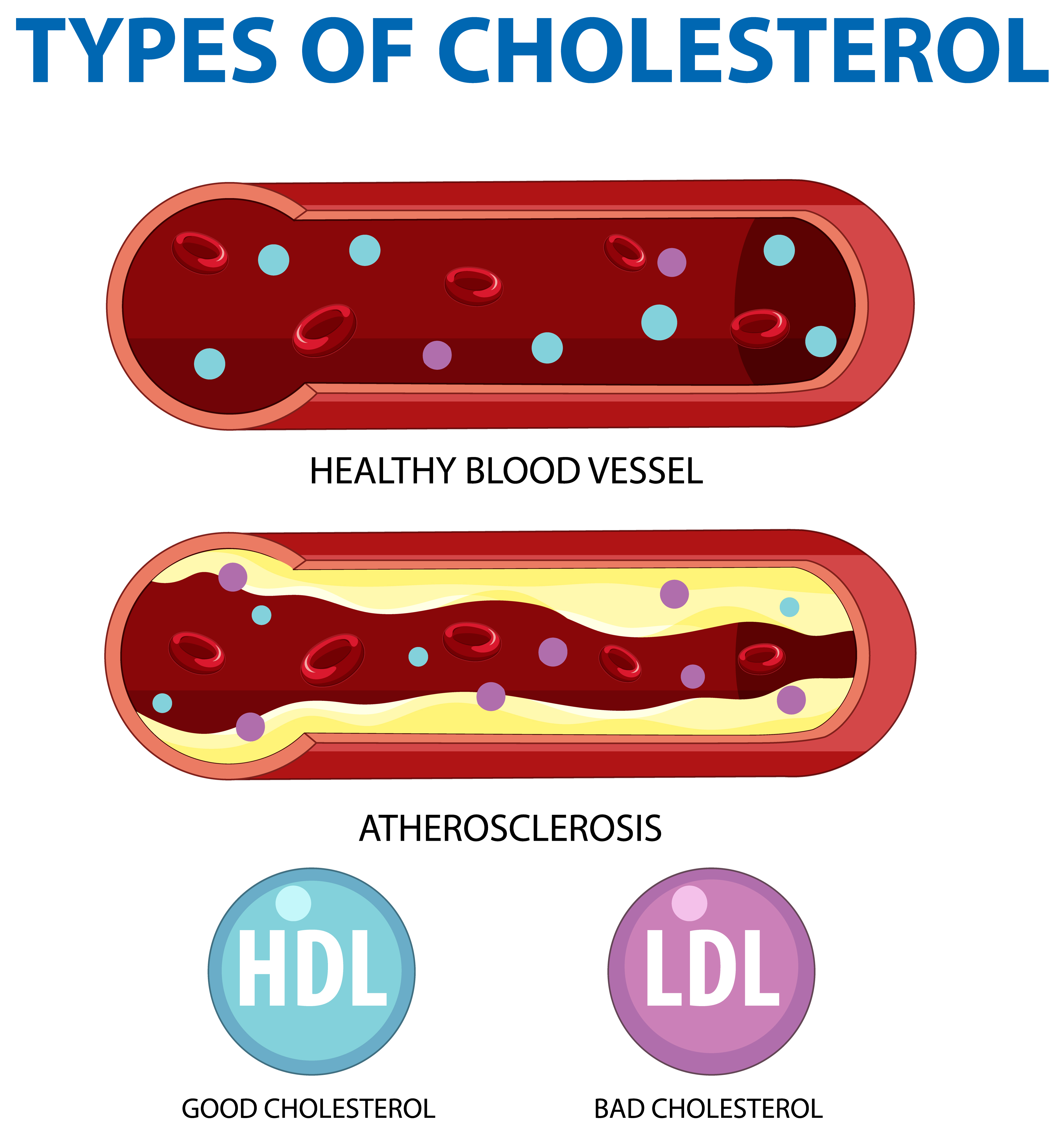 Kolesterol Tidak Perlu Diobati? Kenali Kolesterol Baik